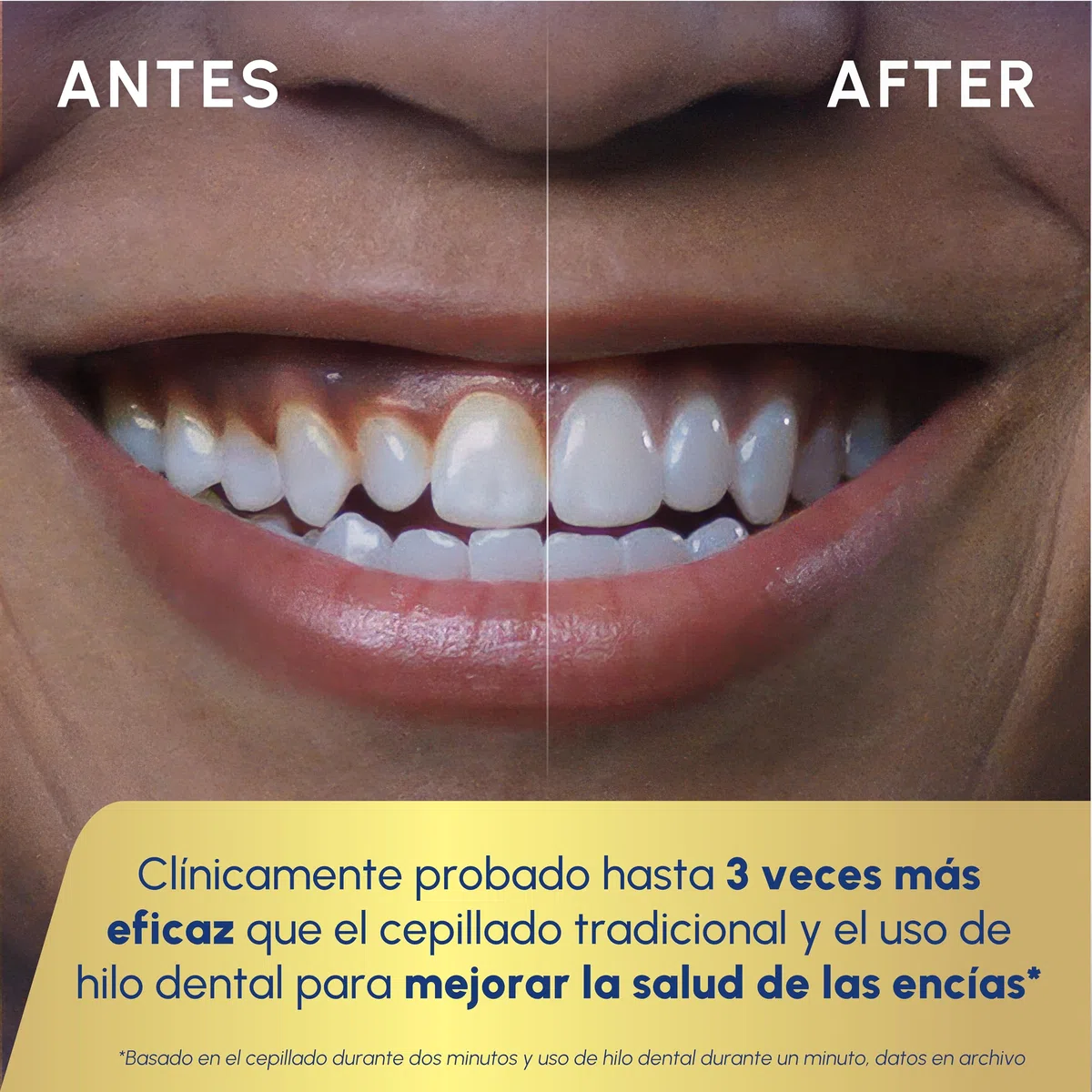 Waterpik Sensonic Complete Care CC-04 Cepillo de dientes eléctrico recargable hilo dental blanco
